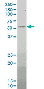 MEF2D Antibody in Western Blot (WB)