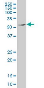 MEF2D Antibody in Western Blot (WB)