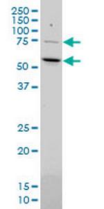 MEF2D Antibody in Western Blot (WB)