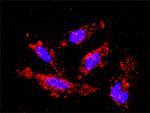 MAP3K1 Antibody in Proximity Ligation Assay (PLA) (PLA)