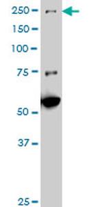 MAP3K4 Antibody in Western Blot (WB)