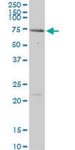 MEN1 Antibody in Western Blot (WB)