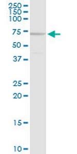 MEN1 Antibody in Western Blot (WB)