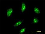 MEOX2 Antibody in Immunocytochemistry (ICC/IF)