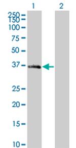 MEOX2 Antibody in Western Blot (WB)