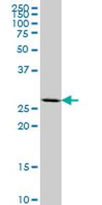 MEOX2 Antibody in Western Blot (WB)