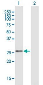 MFAP2 Antibody in Western Blot (WB)