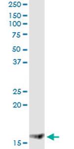 MGST2 Antibody in Immunoprecipitation (IP)