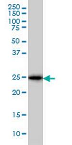 CD99 Antibody in Western Blot (WB)