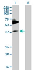 MICA Antibody in Western Blot (WB)