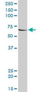 MMP3 Antibody in Western Blot (WB)