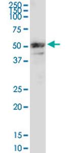 MMP3 Antibody in Western Blot (WB)