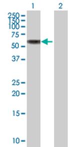 MMP8 Antibody in Western Blot (WB)