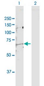 MMP14 Antibody in Western Blot (WB)