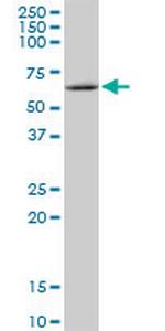 MMP19 Antibody in Western Blot (WB)