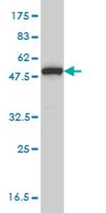 MPP1 Antibody in Western Blot (WB)