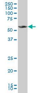 MPP1 Antibody in Western Blot (WB)