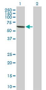 MPP2 Antibody in Western Blot (WB)