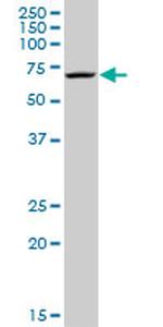 MPP2 Antibody in Western Blot (WB)