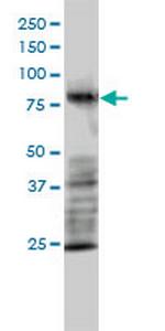 MRE11A Antibody in Western Blot (WB)