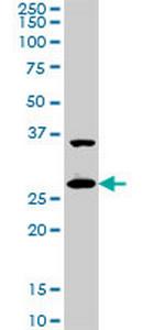 CITED1 Antibody in Western Blot (WB)