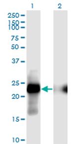 CITED1 Antibody in Western Blot (WB)