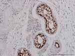 CITED1 Antibody in Immunohistochemistry (Paraffin) (IHC (P))