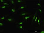 MSH2 Antibody in Immunocytochemistry (ICC/IF)