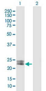 MSRA Antibody in Western Blot (WB)