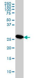 MTAP Antibody in Western Blot (WB)