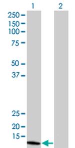 NUDT1 Antibody in Western Blot (WB)