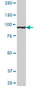 MTHFD1 Antibody in Western Blot (WB)