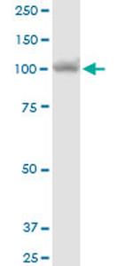 MTHFD1 Antibody in Western Blot (WB)