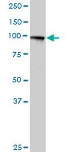 MTHFD1 Antibody in Western Blot (WB)