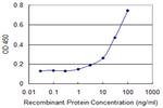 MUSK Antibody in ELISA (ELISA)