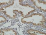 MUSK Antibody in Immunohistochemistry (Paraffin) (IHC (P))