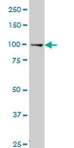 MUSK Antibody in Western Blot (WB)