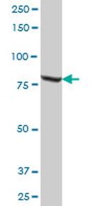 MUT Antibody in Western Blot (WB)