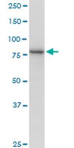 MUT Antibody in Western Blot (WB)