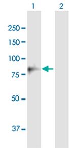 MUT Antibody in Western Blot (WB)