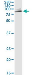 MUTYH Antibody in Immunoprecipitation (IP)