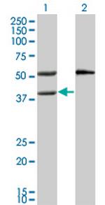 MVK Antibody in Western Blot (WB)