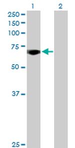 MYBL2 Antibody in Western Blot (WB)