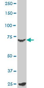 MYBL2 Antibody in Western Blot (WB)