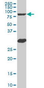 MYBL2 Antibody in Western Blot (WB)