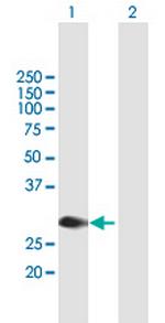 MYCL1 Antibody in Western Blot (WB)