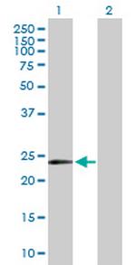 MYCL1 Antibody in Western Blot (WB)