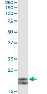 MYL2 Antibody in Immunoprecipitation (IP)