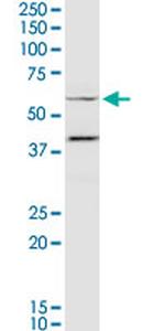 MYOC Antibody in Western Blot (WB)