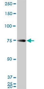 HNRPM Antibody in Western Blot (WB)